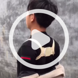 ویدیو قوزبند پروانه ای سفید